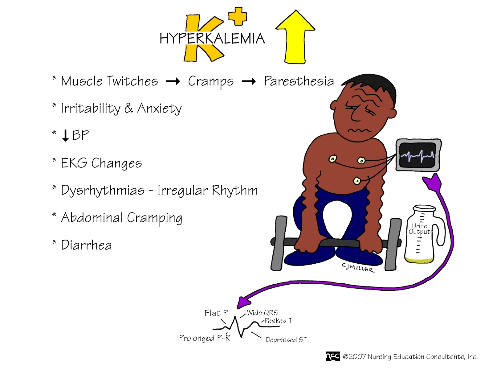 Symptoms Of Hyperkalemia In Adults